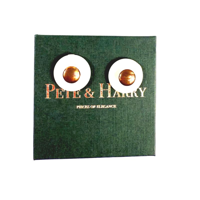 Button Cufflinks